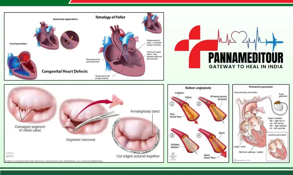 Cardiac Procedures