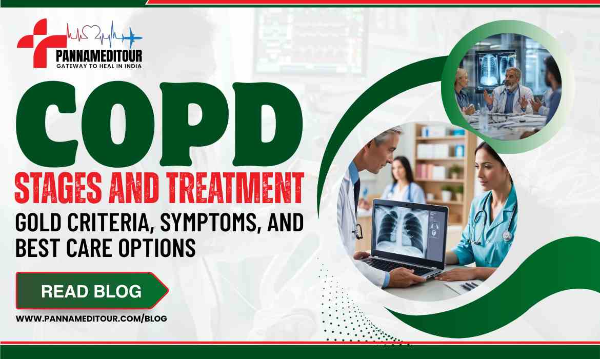 COPD Stages and Treatment: GOLD Criteria, Symptoms, and Best Care Options
