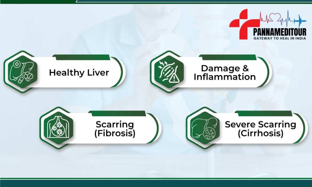 End-Stage Liver Disease Develop